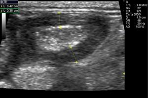 Echographie clinique vétérinaire Les Angles